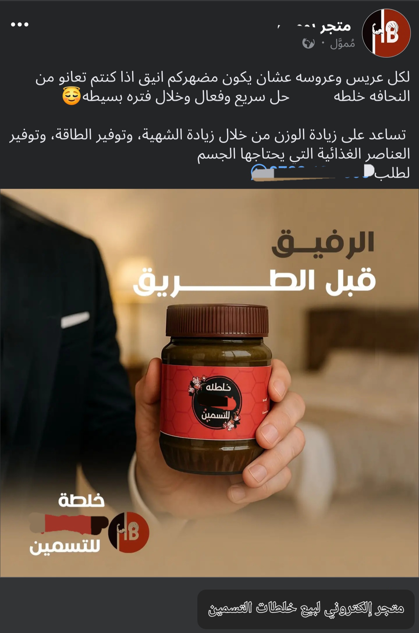 بحثاً عن أجسام مثالية  خلطات تسمين قاتلة تقود يمنيات إلى حافة "الموت"